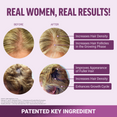 Before and after results showcasing increased hair density, fuller hair, and enhanced hair growth cycle with a patented ingredient.